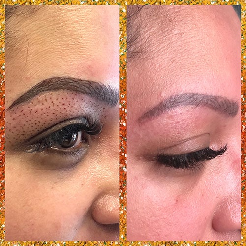 Microblading