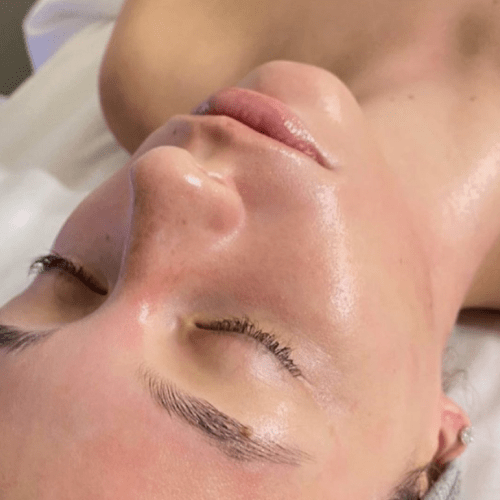 HydraFacial