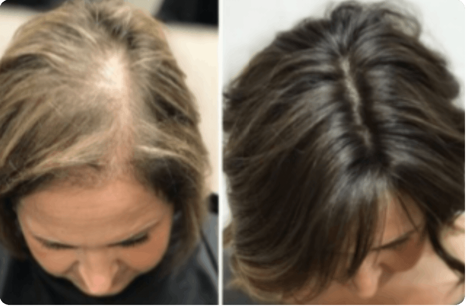 Gifted Creations Salon & Restoration Hairloss Clinic is a Hair Salon in