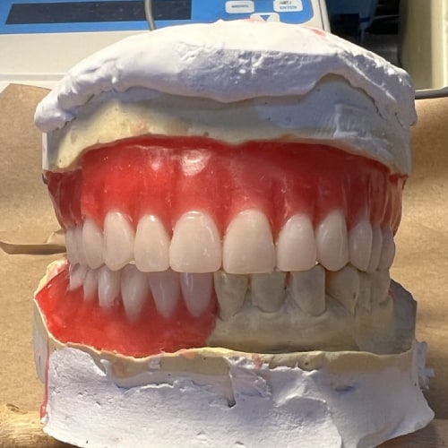 Dentures