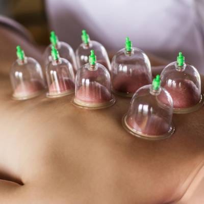 CUPPING