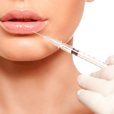 DERMAL FILLER