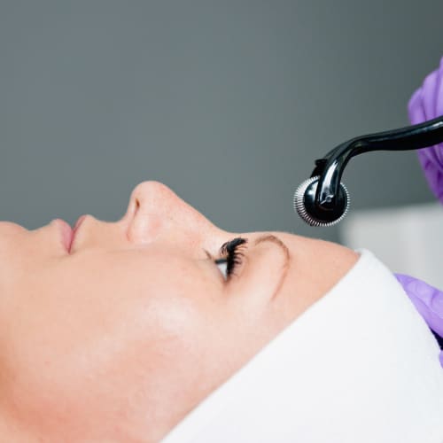 Microneedling