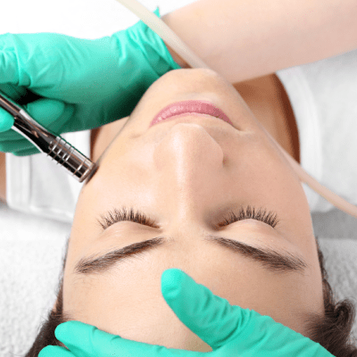 MICRODERMABRASION