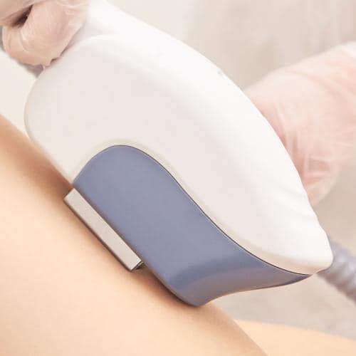 Laser Hair Removal