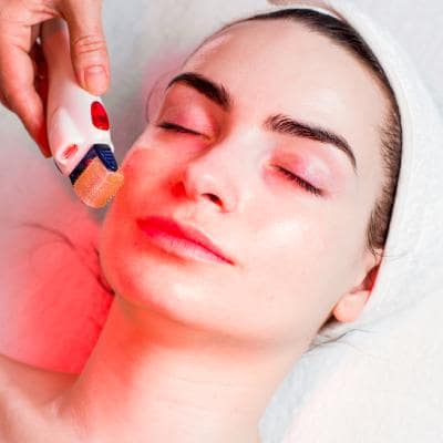 MICRONEEDLING