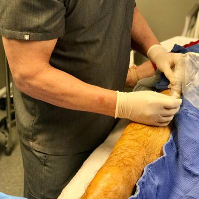 STEM CELLS THERAPY