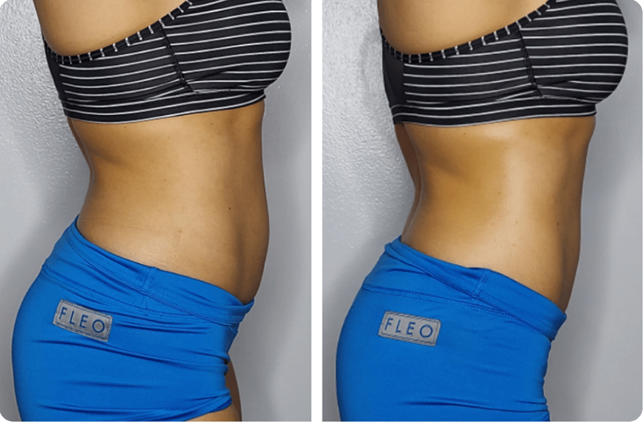 Body Sculpting Training 