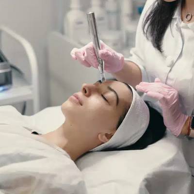 RF MICRONEEDLING