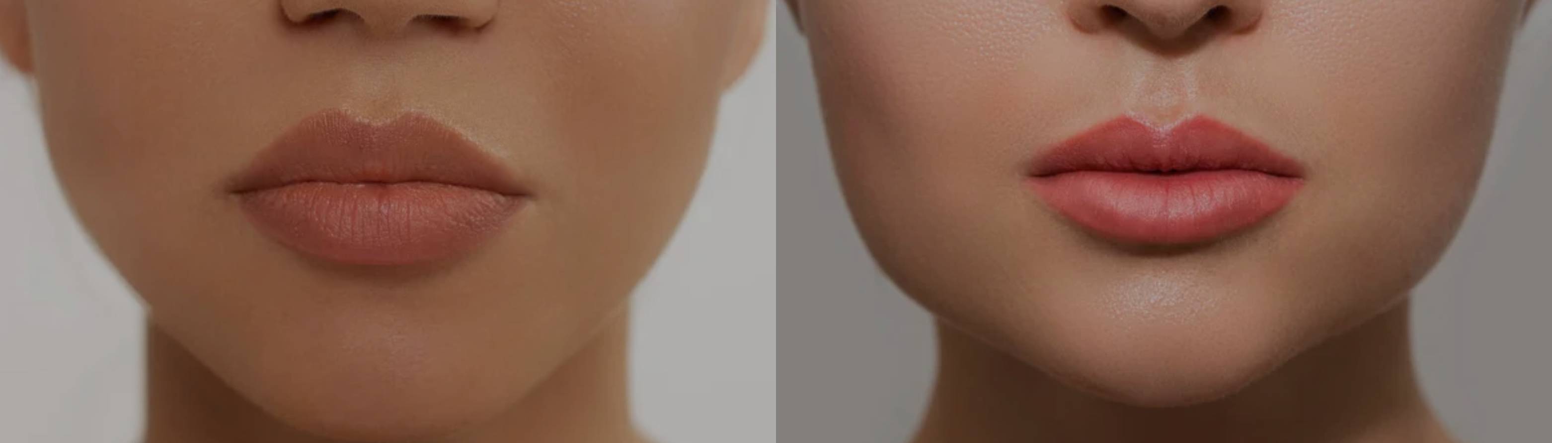 Evenflow PMU and Tattoo Offers Lip Blushing in Billings, MT 59102