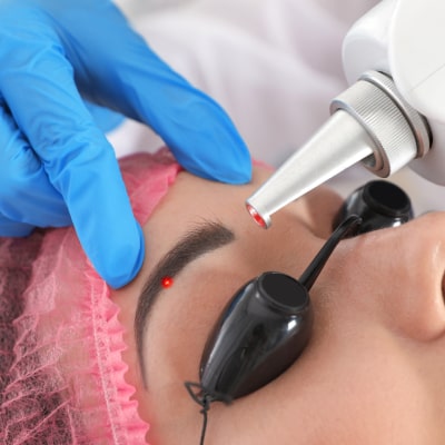 PERMANENT MAKEUP REMOVAL