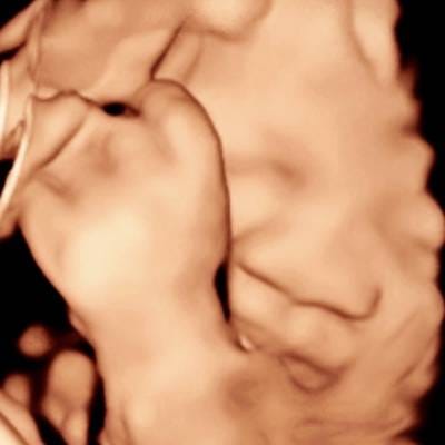 4D ULTRASOUND