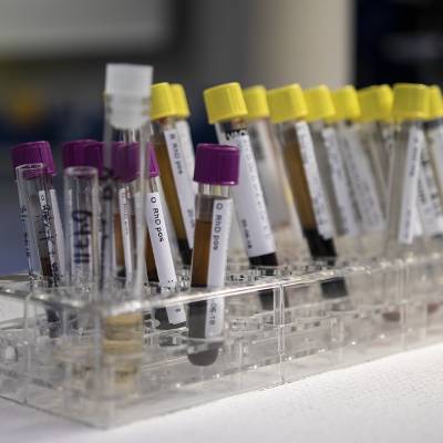 DIAGNOSTIC TESTING