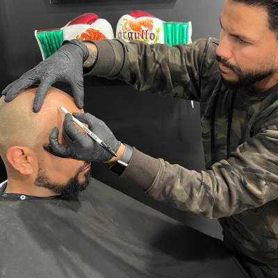 SCALP MICROPIGMENTATION