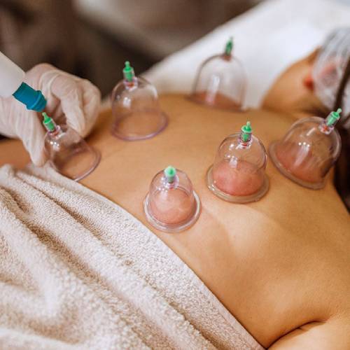 Cupping Massage