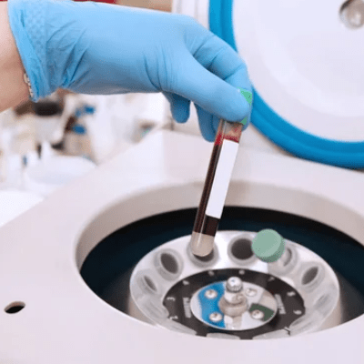 MOBILE LABORATORY SERVICES