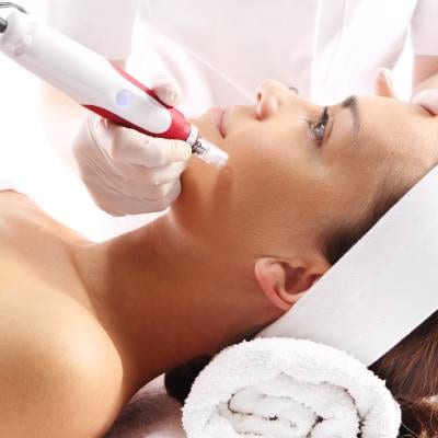 MICRONEEDLING
