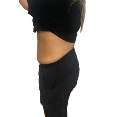 WEIGHT LOSS MANAGEMENT