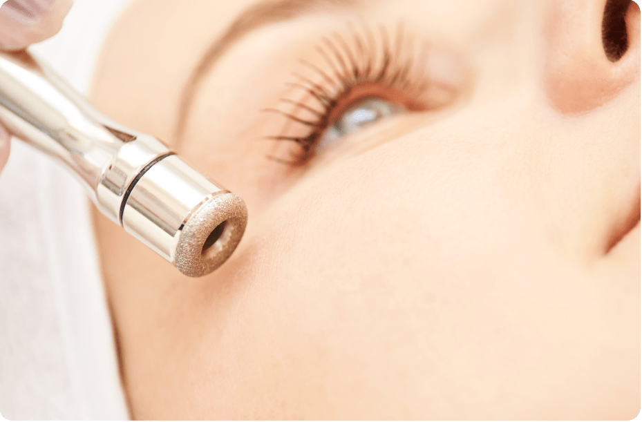 Microdermabrasion