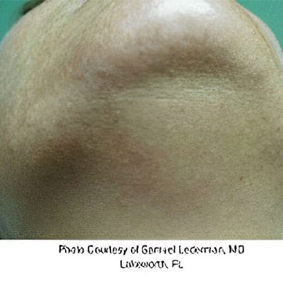 ELECTROLOGY SERVICES