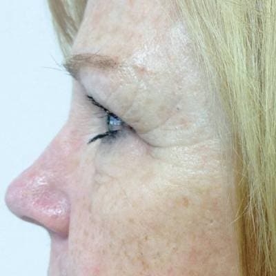 ANTI AGING TREATMENT