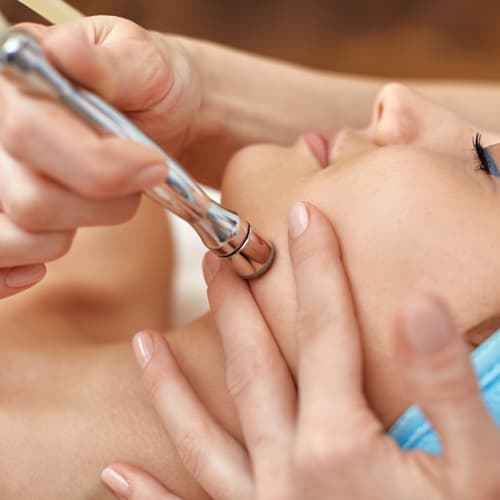 Microdermabrasion
