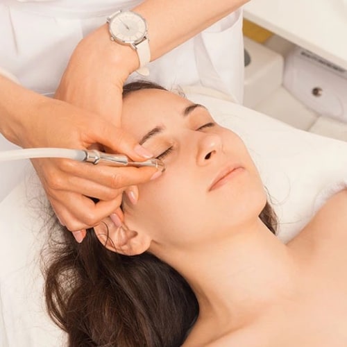 Microdermabrasion