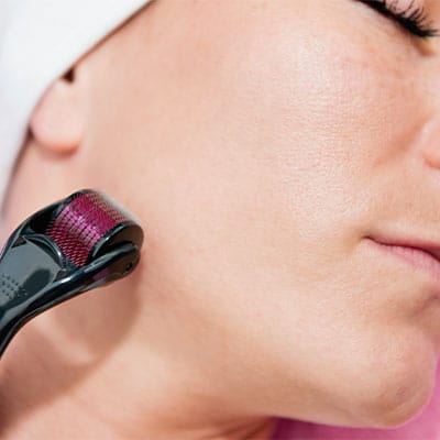 MICRONEEDLING 