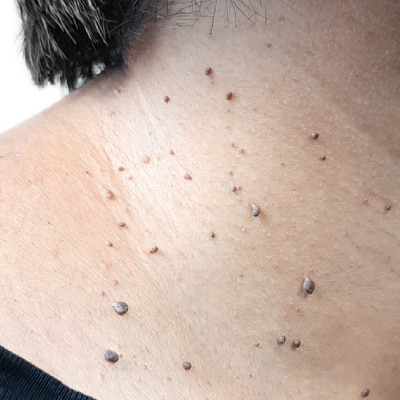 DERMATOLOGY SERVICES