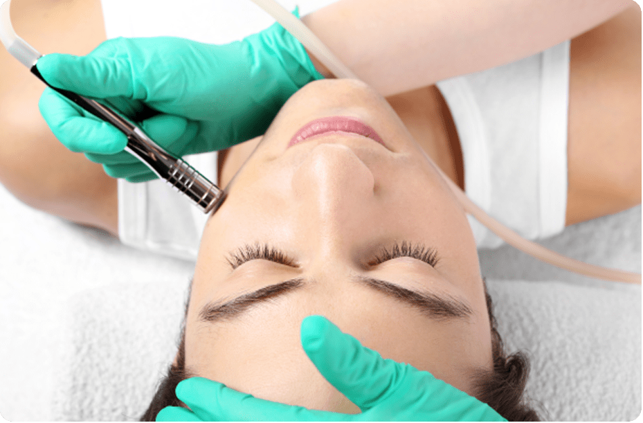 Microdermabrasion