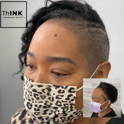 SCALP MICROPIGMENTATION