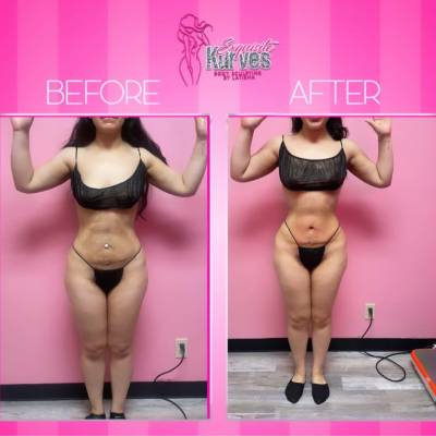 Body Sculpting