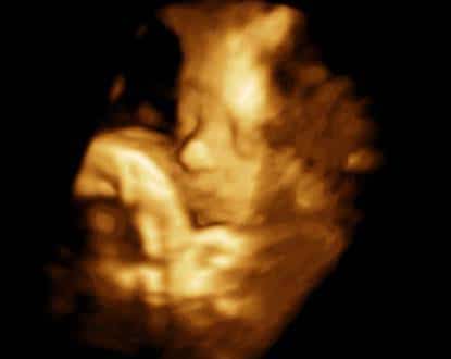 GENDER DETERMINATION