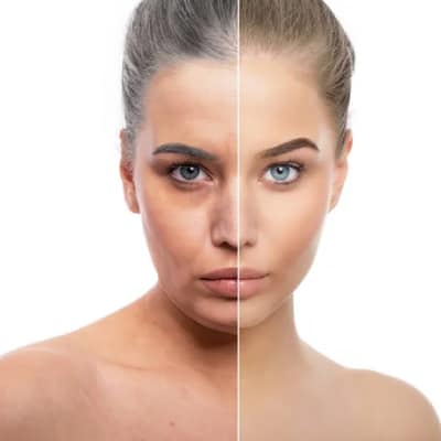 ANTI-AGING TREATMENTS