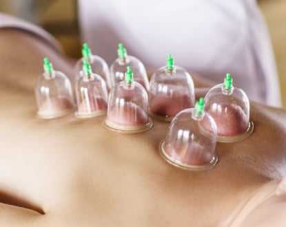 CUPPING THERAPY