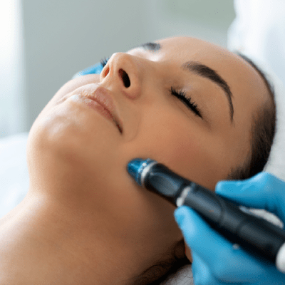 HYDRAFACIAL
