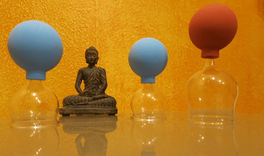 Hijama Cupping Wellness