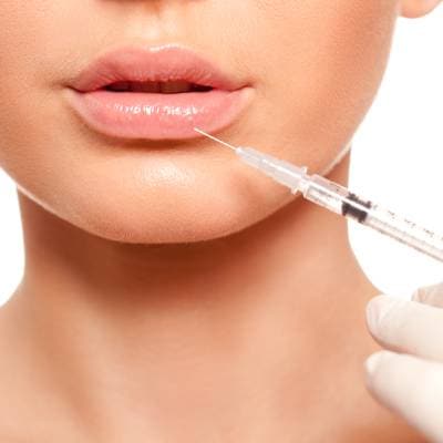 LIP FILLERS