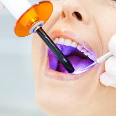 TEETH WHITENING TREATMENTS