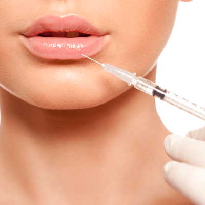 LIP FILLER