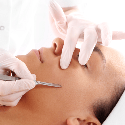 DERMAPLANING