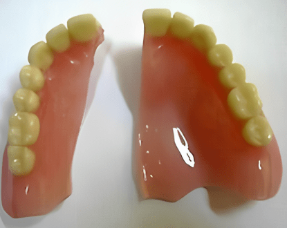 DENTURE REPAIR