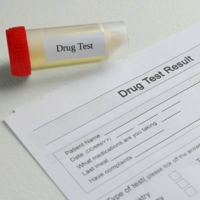MOBILE EMPLOYMENT DRUG SCREENING