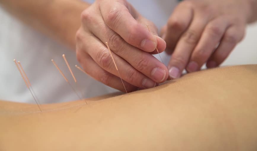 Chapman Acupuncture Clinic- Betty Rigi