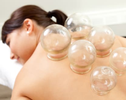 CUPPING