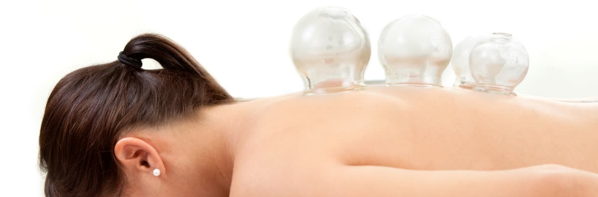 Cupping Treatment