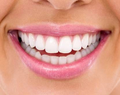 TEETH WHITENING
