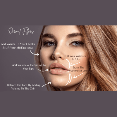 DERMAL FILLERS
