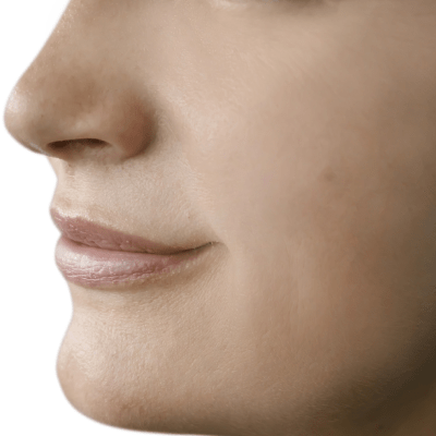 ANTI-WRINKLE TREATMENTS