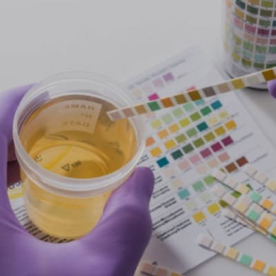 URINE DRUG TESTING